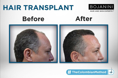 Slider image (1) BOJANINI HAIR & SKIN EXPERTS CANC